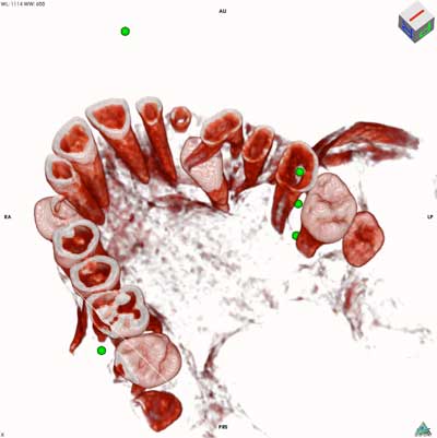 dvt-kfo-2.jpg
